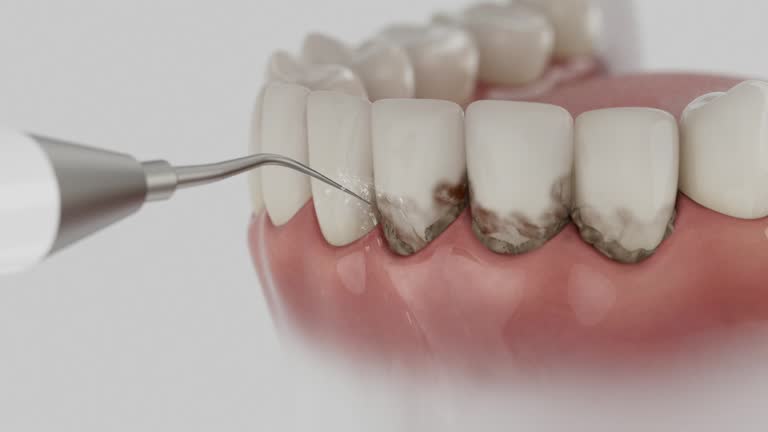 Reliable Wisdom Tooth Removal contractor in Calhoun County County, AL by Dentist Open Now